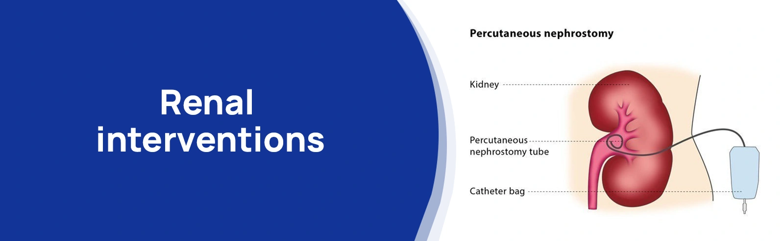 Renal interventions 01